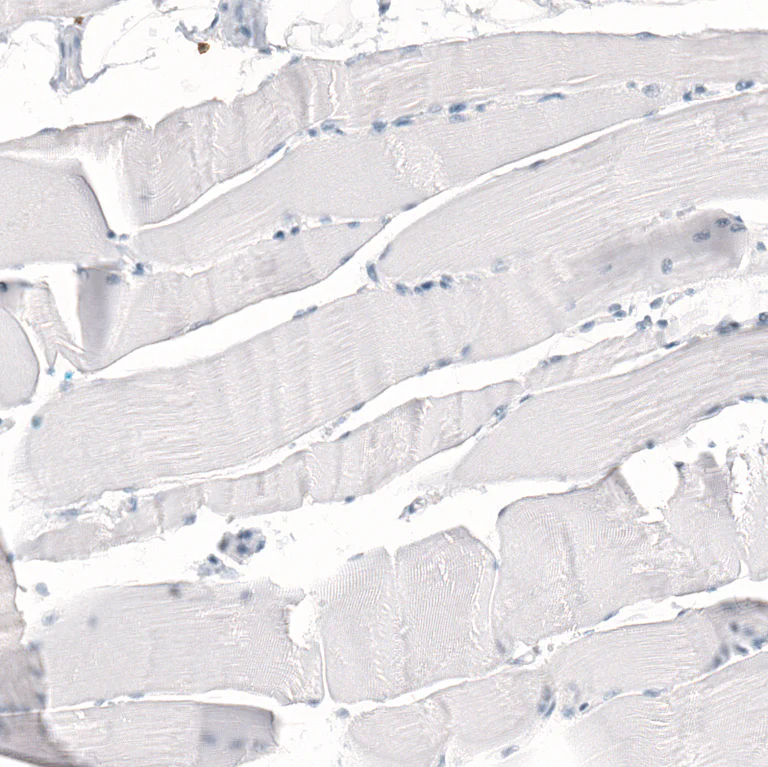 Immunohistochemistry (Formalin/PFA-fixed paraffin-embedded sections) - Anti-CD5 Antibody [CL12420] (AB327141)