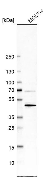 Western blot - Anti-CD5 Antibody [CL12420] (AB327141)