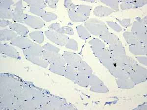 Immunohistochemistry (Formalin/PFA-fixed paraffin-embedded sections) - Anti-CD5 antibody [EP2952] (AB75877)
