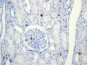Immunohistochemistry (Formalin/PFA-fixed paraffin-embedded sections) - Anti-CD5 antibody [EP2952] (AB75877)