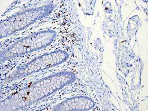 Immunohistochemistry (Formalin/PFA-fixed paraffin-embedded sections) - Anti-CD5 antibody [EP2952] (AB75877)