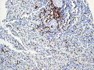 Immunohistochemistry (Formalin/PFA-fixed paraffin-embedded sections) - Anti-CD5 antibody [EP2952] (AB75877)