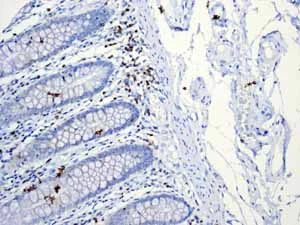 Immunohistochemistry (Formalin/PFA-fixed paraffin-embedded sections) - Anti-CD5 antibody [EP2952] - BSA and Azide free (AB194821)