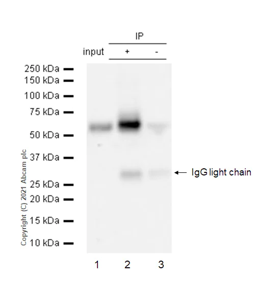 Immunoprecipitation - Anti-CD5 antibody [EP2952] - BSA and Azide free (AB194821)