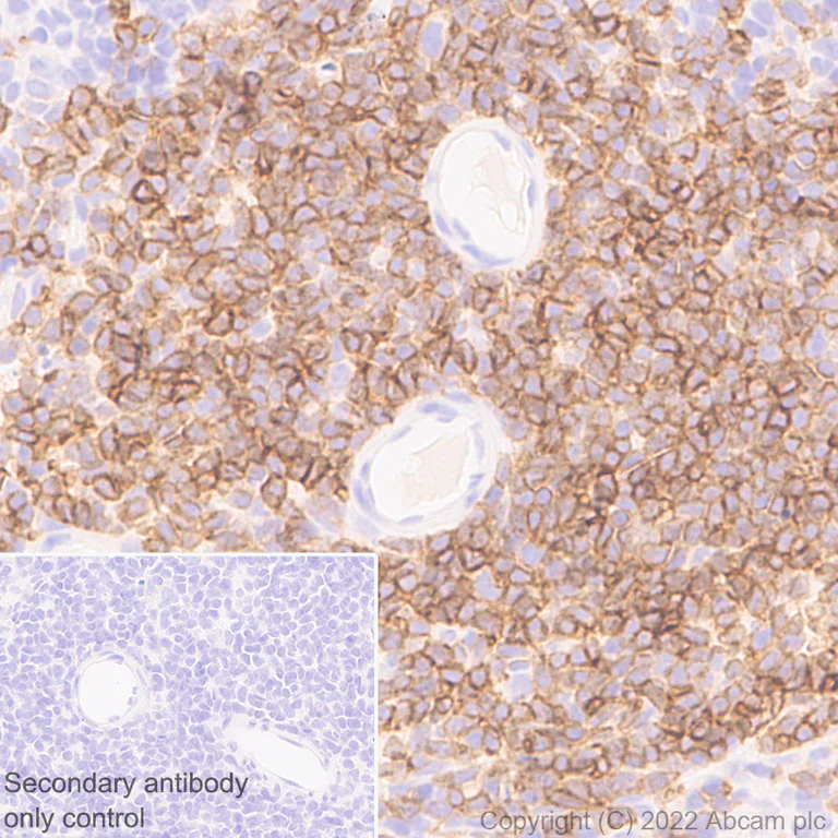 Immunohistochemistry (Formalin/PFA-fixed paraffin-embedded sections) - Anti-CD5 antibody [EPR26533-75] (AB300423)