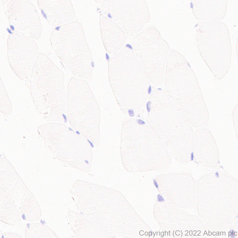 Immunohistochemistry (Formalin/PFA-fixed paraffin-embedded sections) - Anti-CD5 antibody [EPR26533-75] (AB300423)