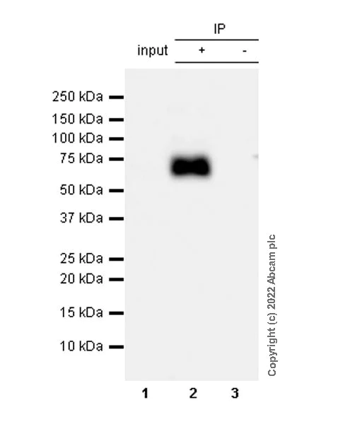 Immunoprecipitation - Anti-CD5 antibody [EPR26533-75] (AB300423)