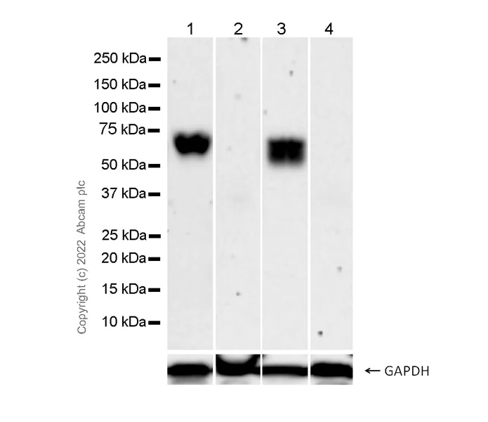 Western blot - Anti-CD5 antibody [EPR26533-75] (AB300423)