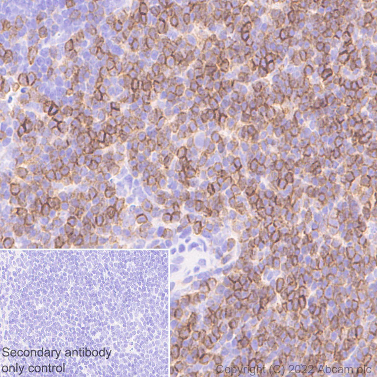 Immunohistochemistry (Formalin/PFA-fixed paraffin-embedded sections) - Anti-CD5 antibody [EPR26533-75] (BSA and Azide free) (AB300424)