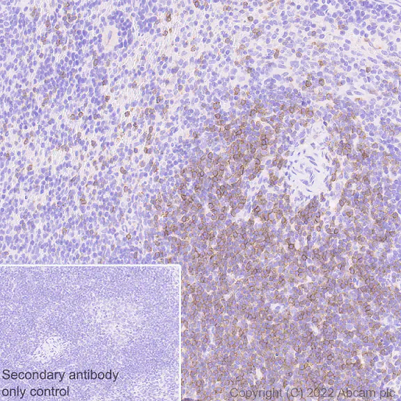 Immunohistochemistry (Formalin/PFA-fixed paraffin-embedded sections) - Anti-CD5 antibody [EPR26534-47] (BSA and Azide free) (AB300121)