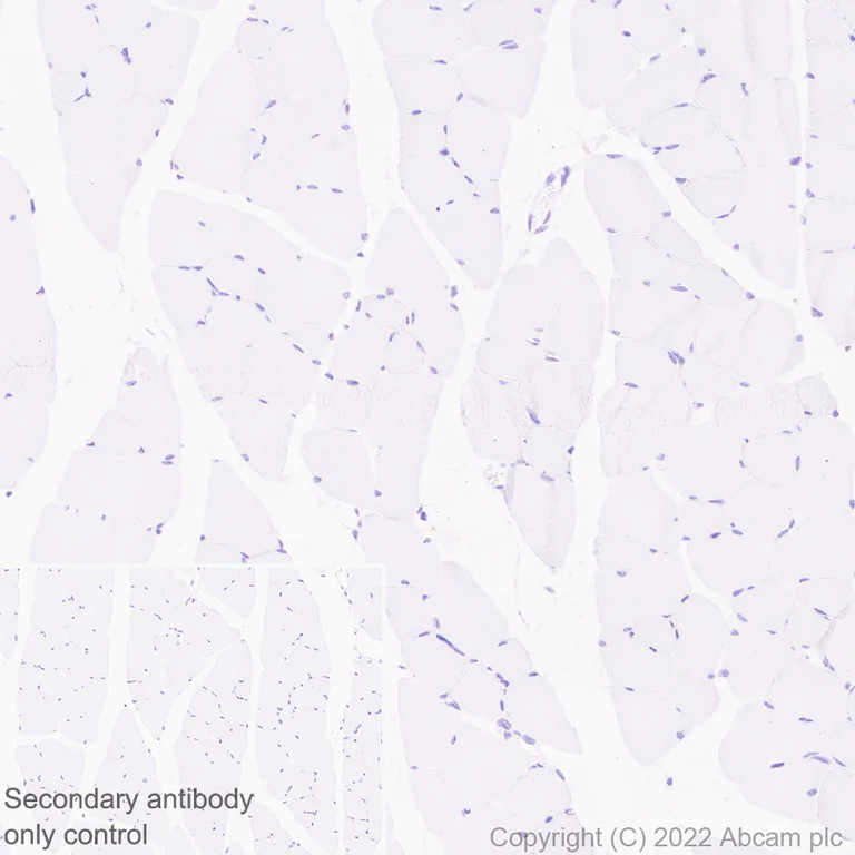 Immunohistochemistry (Formalin/PFA-fixed paraffin-embedded sections) - Anti-CD5 antibody [EPR26534-47] (BSA and Azide free) (AB300121)