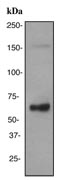 Western blot - Anti-CD5 antibody [EPR2953] (AB134174), expandable thumbnail