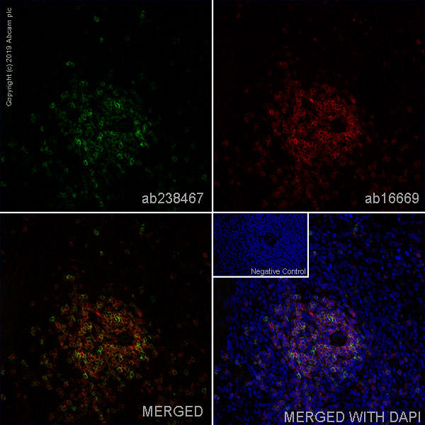 Immunohistochemistry (Frozen sections) - Anti-CD5 antibody [OX19] - BSA and Azide free (AB244582), expandable thumbnail