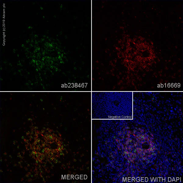 Immunohistochemistry (Frozen sections) - Anti-CD5 antibody [OX19] - BSA and Azide free (AB244582)