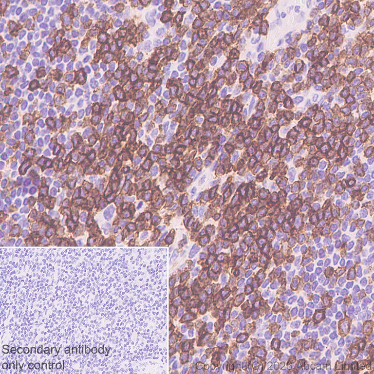 Immunohistochemistry (Formalin/PFA-fixed paraffin-embedded sections) - Anti-CD5 antibody [RM1352] (AB325643)