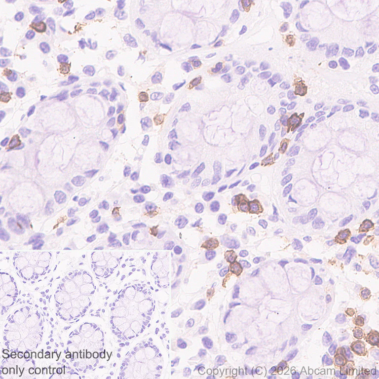 Immunohistochemistry (Formalin/PFA-fixed paraffin-embedded sections) - Anti-CD5 antibody [RM1352] (AB325643)