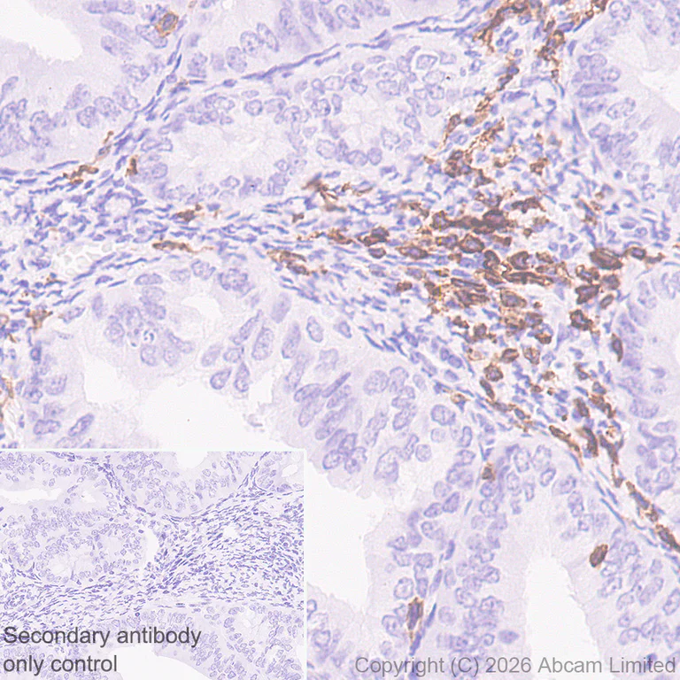 Immunohistochemistry (Formalin/PFA-fixed paraffin-embedded sections) - Anti-CD5 antibody [RM1352] (AB325643)