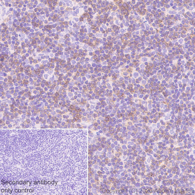 Immunohistochemistry (Formalin/PFA-fixed paraffin-embedded sections) - Anti-CD5 antibody [RM1352] (AB325643)
