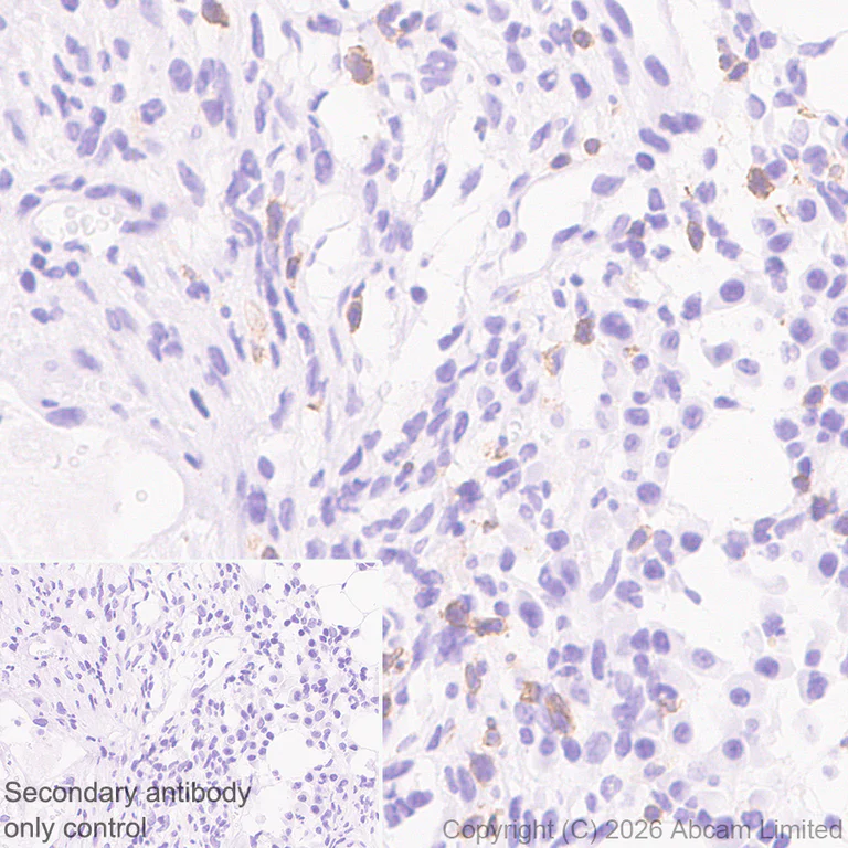 Immunohistochemistry (Formalin/PFA-fixed paraffin-embedded sections) - Anti-CD5 antibody [RM1352] (AB325643)