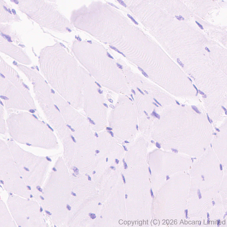 Immunohistochemistry (Formalin/PFA-fixed paraffin-embedded sections) - Anti-CD5 antibody [RM1352] (AB325643)