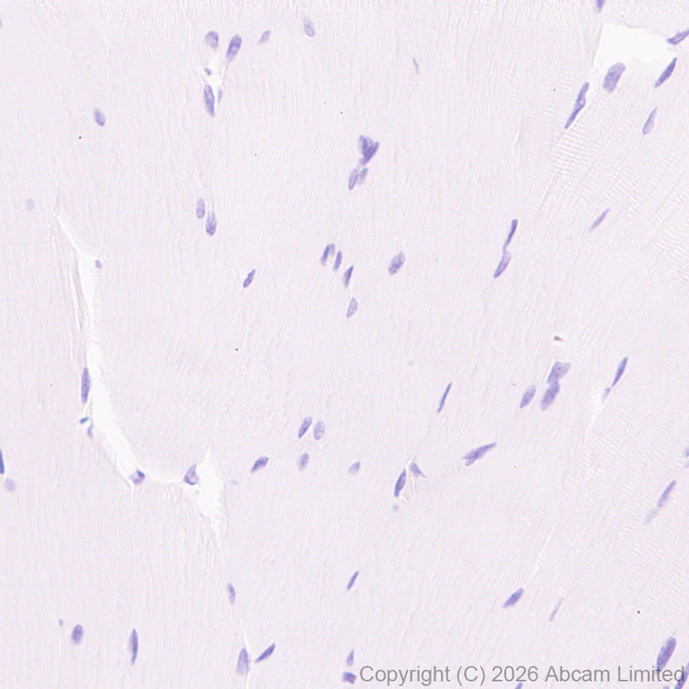 Immunohistochemistry (Formalin/PFA-fixed paraffin-embedded sections) - Anti-CD5 antibody [RM1352] (AB325643)