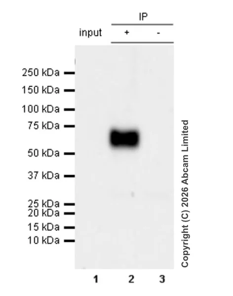 Immunoprecipitation - Anti-CD5 antibody [RM1352] (AB325643)