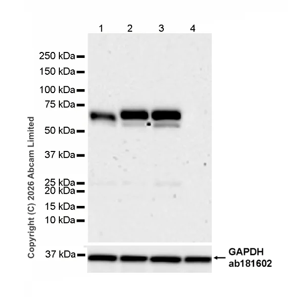 Western blot - Anti-CD5 antibody [RM1352] (AB325643)