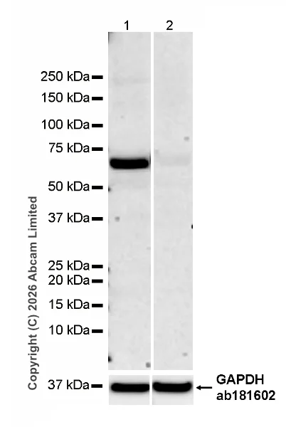 Western blot - Anti-CD5 antibody [RM1352] (AB325643)