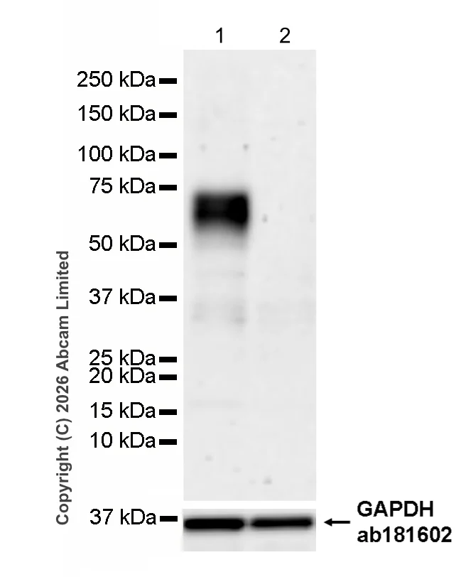 Western blot - Anti-CD5 antibody [RM1352] (AB325643)