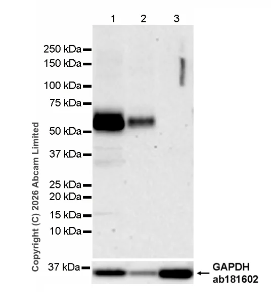 Western blot - Anti-CD5 antibody [RM1352] (AB325643)