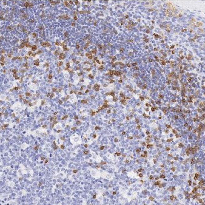 Immunohistochemistry (Formalin/PFA-fixed paraffin-embedded sections) - Anti-CD5 antibody [SP19] (AB16699)