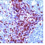 Immunohistochemistry (Formalin/PFA-fixed paraffin-embedded sections) - Anti-CD5 antibody [SP19] - BSA and Azide free (AB239796), expandable thumbnail