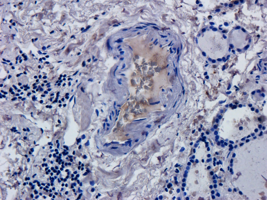Immunohistochemistry (Formalin/PFA-fixed paraffin-embedded sections) - Anti-CD52 antibody [Campath-1H] (AB245681)