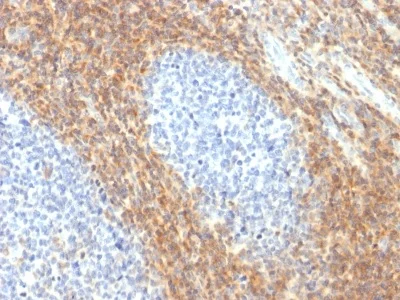 Immunohistochemistry (Formalin/PFA-fixed paraffin-embedded sections) - Anti-CD52 antibody [CD52/2276R] - BSA and Azide free (AB236371)
