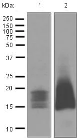Western blot - Anti-CD52 antibody [EPR3153(2)] - BSA and Azide free (AB248110)