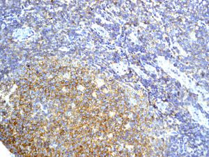 Immunohistochemistry (Formalin/PFA-fixed paraffin-embedded sections) - Anti-CD53 antibody [EPR4342(2)] (AB134094), expandable thumbnail