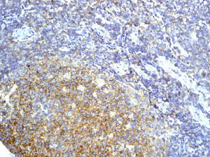 Immunohistochemistry (Formalin/PFA-fixed paraffin-embedded sections) - Anti-CD53 antibody [EPR4342(2)] (AB134094)