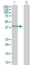 Western blot - CD55 293T Transfected Lysate - (positive control) (AB94035)