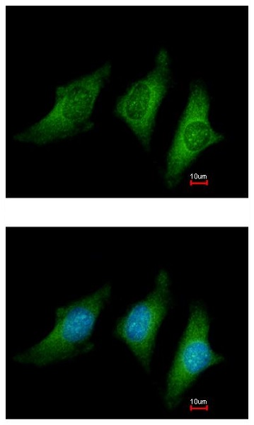 Immunocytochemistry/ Immunofluorescence - Anti-CD55 antibody (AB230638)