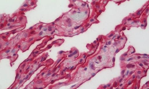 Immunohistochemistry (Formalin/PFA-fixed paraffin-embedded sections) - Anti-CD55 antibody (AB230638)