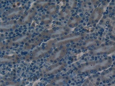 Immunohistochemistry (Formalin/PFA-fixed paraffin-embedded sections) - Anti-CD55 antibody (AB231734)