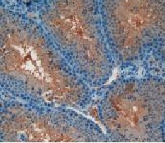 Immunohistochemistry (Formalin/PFA-fixed paraffin-embedded sections) - Anti-CD55 antibody (AB231734)