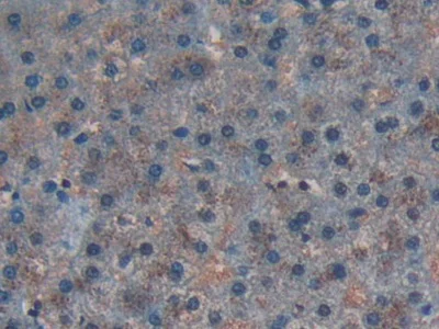 Immunohistochemistry (Formalin/PFA-fixed paraffin-embedded sections) - Anti-CD55 antibody (AB232688)