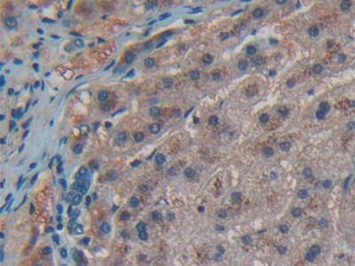 Immunohistochemistry (Formalin/PFA-fixed paraffin-embedded sections) - Anti-CD55 antibody (AB232688)