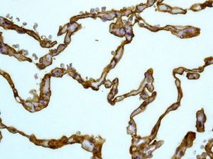 Immunohistochemistry (Formalin/PFA-fixed paraffin-embedded sections) - Anti-CD55 antibody [EPR6689] - BSA and Azide free (AB230797), expandable thumbnail