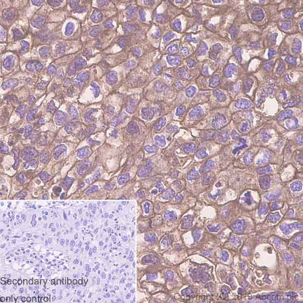 Immunohistochemistry (Formalin/PFA-fixed paraffin-embedded sections) - Anti-CD55 antibody [EPR6689] - BSA and Azide free (AB230797), expandable thumbnail