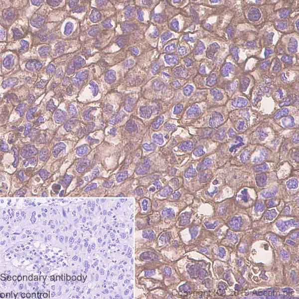 Immunohistochemistry (Formalin/PFA-fixed paraffin-embedded sections) - Anti-CD55 antibody [EPR6689] - BSA and Azide free (AB230797)