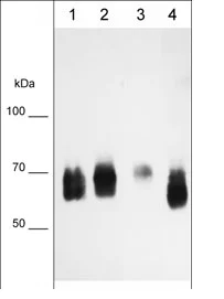 CD55抗体[M002] - Extracellular domain (ab253284)| Abcam中文官网