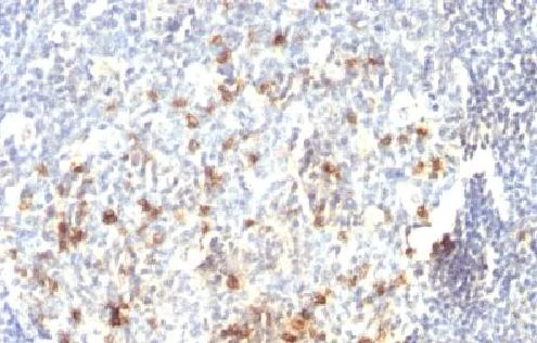 Immunohistochemistry (Formalin/PFA-fixed paraffin-embedded sections) - Anti-CD57 antibody [HNK-1 or Leu-7] - BSA and Azide free (AB212403)