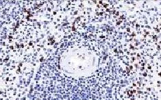 Immunohistochemistry (Formalin/PFA-fixed paraffin-embedded sections) - Anti-CD57 antibody [NK-1] - BSA and Azide free (AB212405)